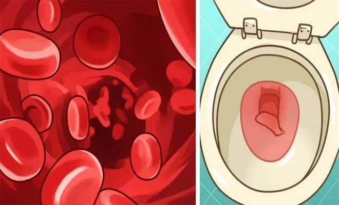 Μήπως έχετε έλλειψη σιδήρου; Δείτε τα συμπτώματα